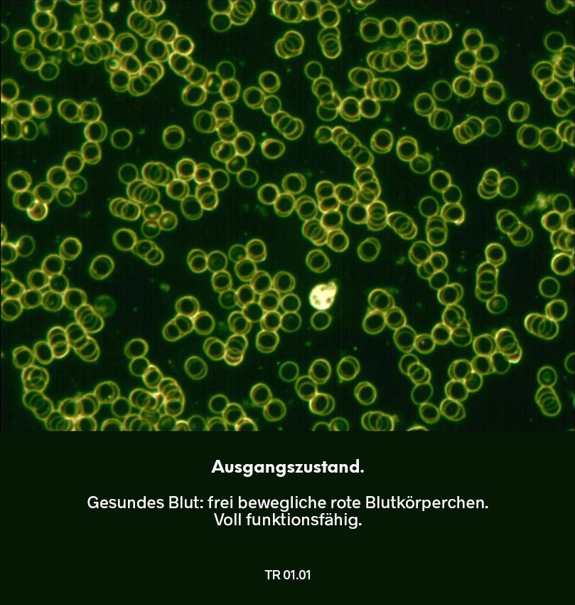 Dunkelfeldmikroskopie Testreihe 01: Ausgangszustand – Blutprobe mit frei beweglichen roten Blutkörperchen ohne Verklumpungen.