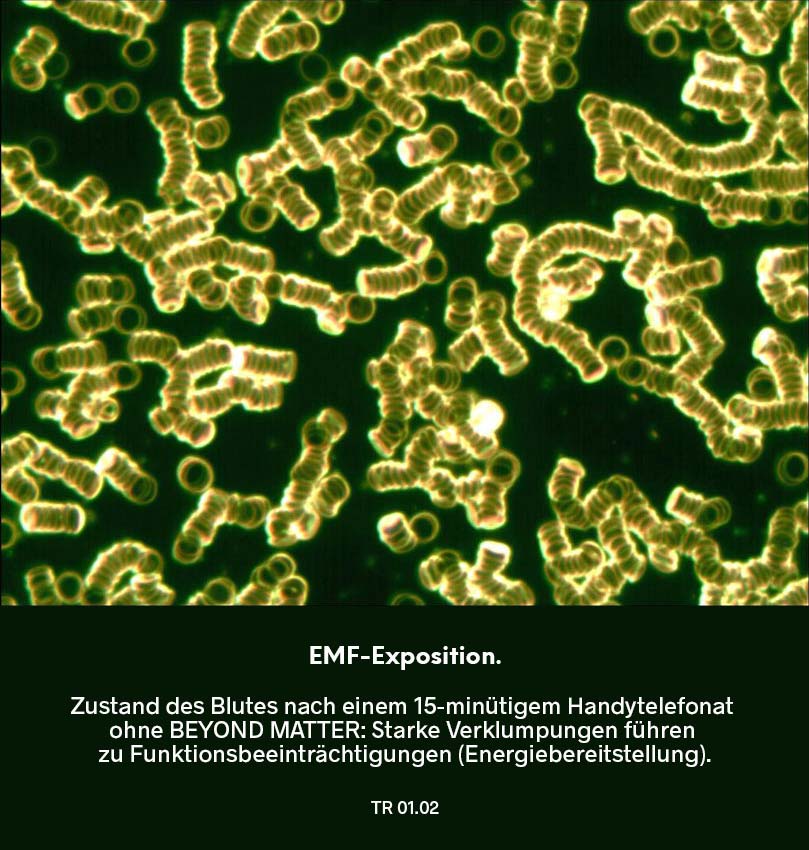 Dunkelfeldmikroskopie Testreihe 01: Blutprobe nach EMF-Exposition – Dauer 15 Minuten: deutliche Verklumpungen der roten Blutkörperchen.