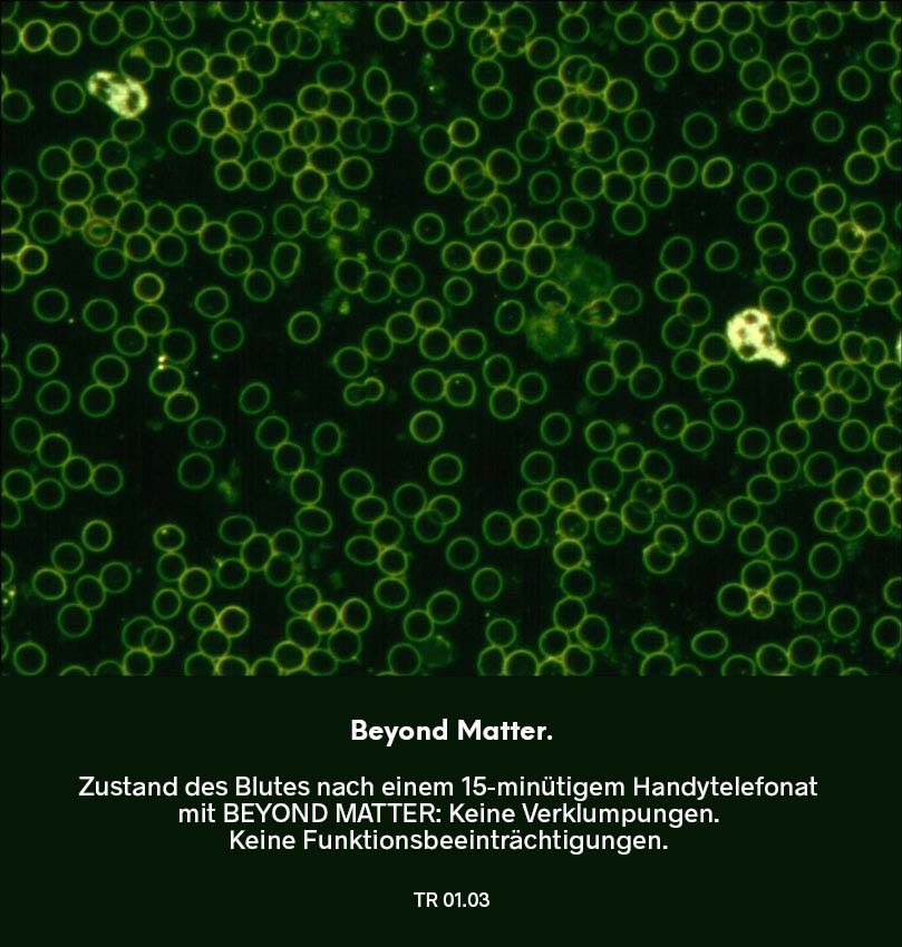 Dunkelfeldmikroskopie Testreihe 01: Blutprobe nach Nutzung von Beyond Matter – Dauer 15 Minuten: frei bewegliche rote Blutkörperchen ohne Verklumpungen und verbesserte Struktur.