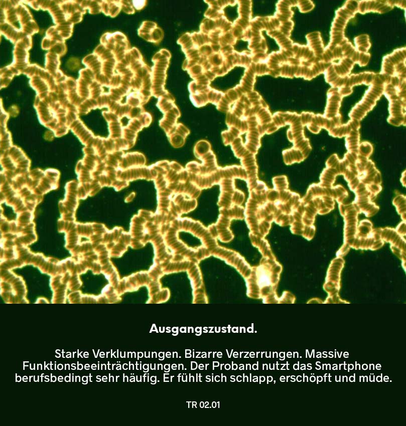 Dunkelfeldmikroskopie Testreihe 02: Ausgangszustand – Blutprobe mit starken Verklumpungen, verzerrten Strukturen und deutlich eingeschränkter Beweglichkeit der roten Blutkörperchen.