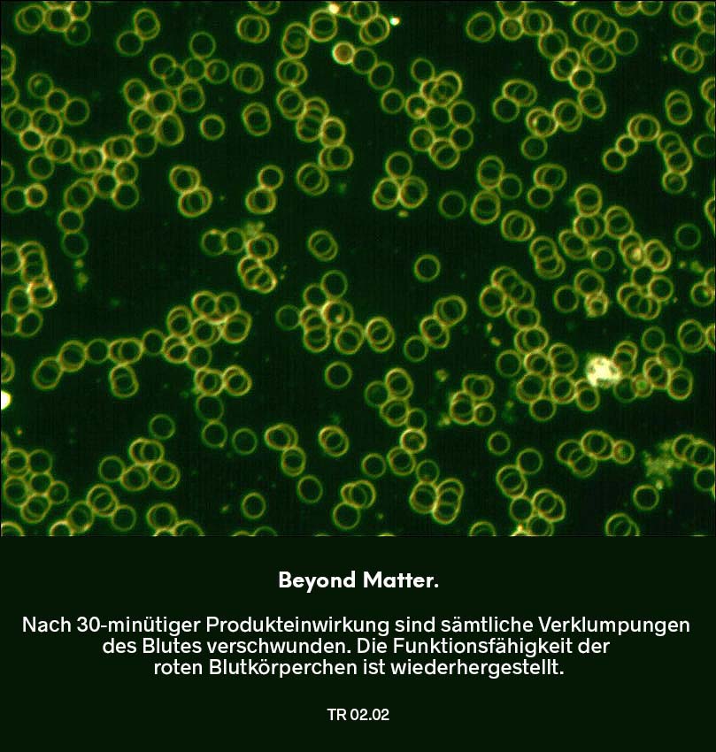 Dunkelfeldmikroskopie Testreihe 02: Blutprobe nach Nutzung von Beyond Matter – Dauer 30 Minuten: frei bewegliche rote Blutkörperchen ohne Verklumpungen und verbesserte Struktur.