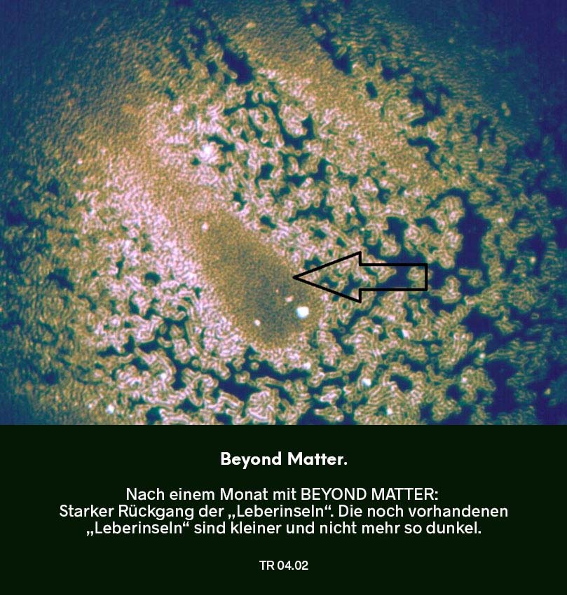 Dunkelfeldmikroskopie Testreihe 03: Blutprobe nach Nutzung von Beyond Matter – Dauer 30 Tage: „Leberinseln“ deutlich reduziert, markierte Bereiche im Bild.