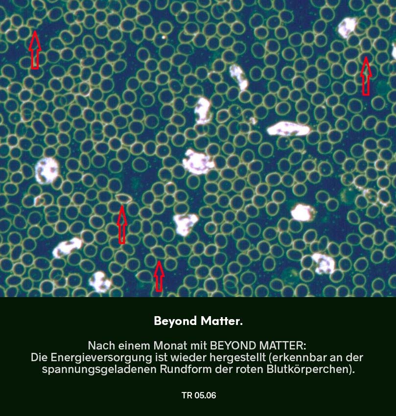 Dunkelfeldmikroskopie Testreihe 04: Blutprobe nach Nutzung von Beyond Matter – vollständiger Rückgang der Verklumpungen der roten Blutkörperchen (Hinweis auf Energieproblem), markierter Bereich im Bild.