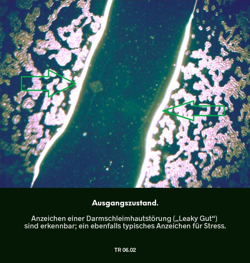 Dunkelfeldmikroskopie Testreihe 05: Ausgangszustand – Blutprobe mit deutlich erkennbarer Darmschleimhautstörung („Leaky Gut“), markiert durch Pfeil.