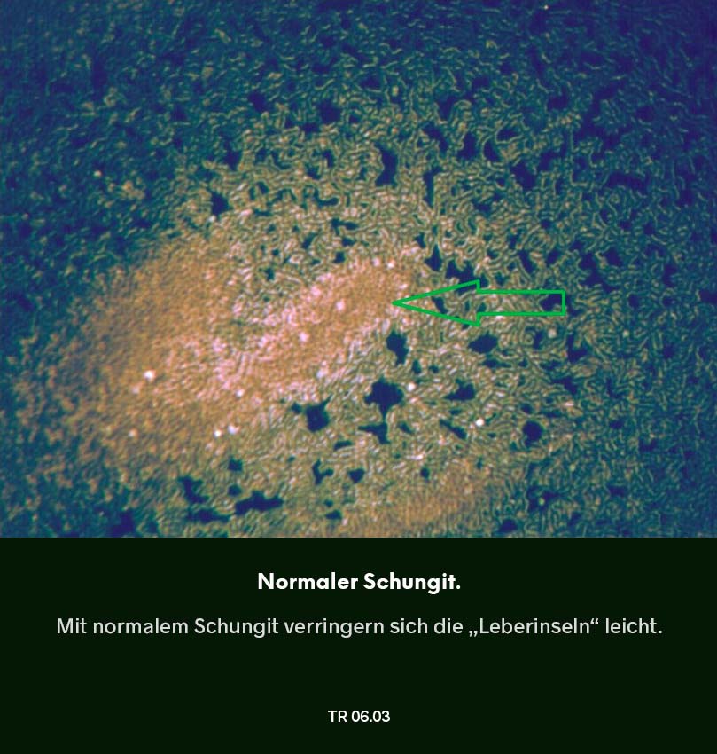 Dunkelfeldmikroskopie Testreihe 05: Blutprobe nach Nutzung von normalem Schungit – „Leberinseln“ gehen leicht reduziert, markierter Bereich im Bild.