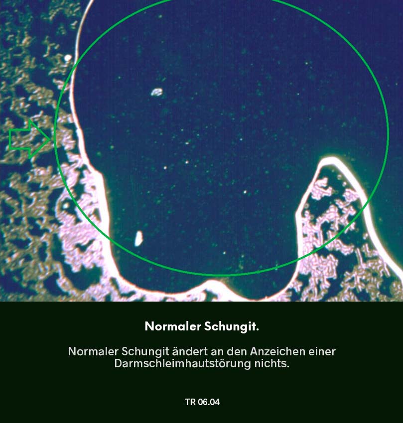Dunkelfeldmikroskopie Testreihe 05: Blutprobe nach Nutzung von normalem Schungit – Darmschleimhautstörung („Leaky Gut“) geht leicht reduziert, markierter Bereich im Bild.