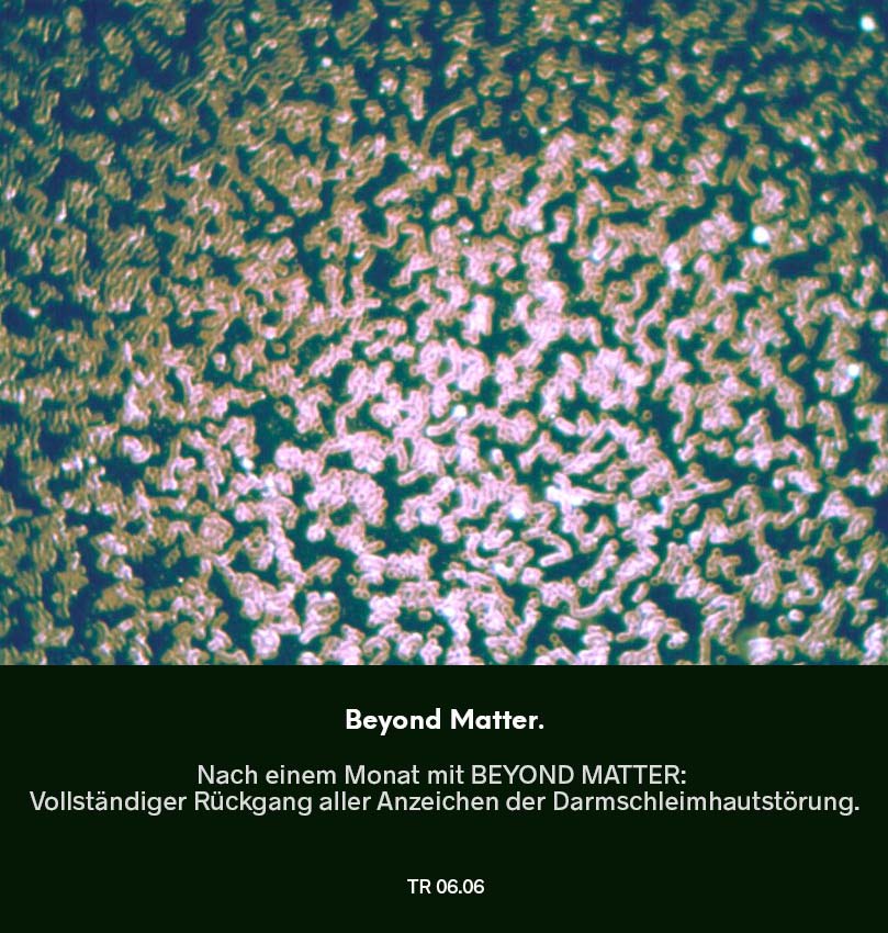 Dunkelfeldmikroskopie Testreihe 05: Blutprobe nach Nutzung von Beyond Matter – vollständiger Rückgang der „Leberinseln“ (Hinweis auf Leberbelastung), markierter Bereich im Bild.