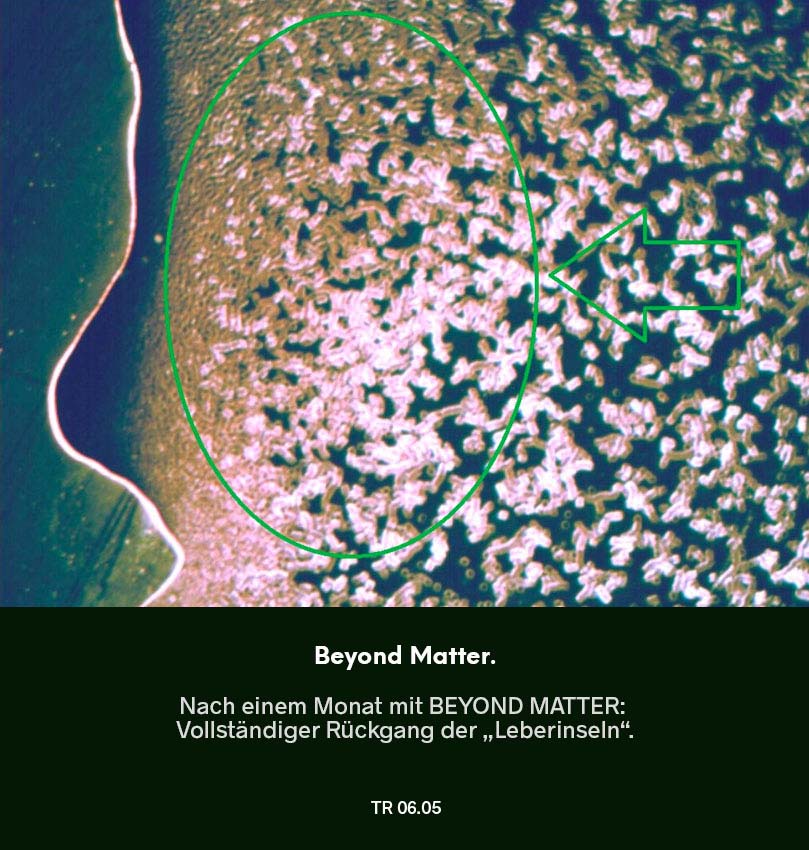 Dunkelfeldmikroskopie Testreihe 05: Blutprobe nach Nutzung von Beyond Matter – vollständiger Rückgang der Darmschleimhautstörung („Leaky Gut“), markierter Bereich im Bild.